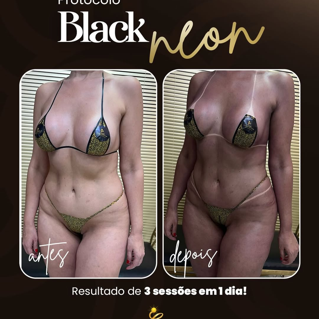 Protocolo Black Neon-resultados em 1 dia