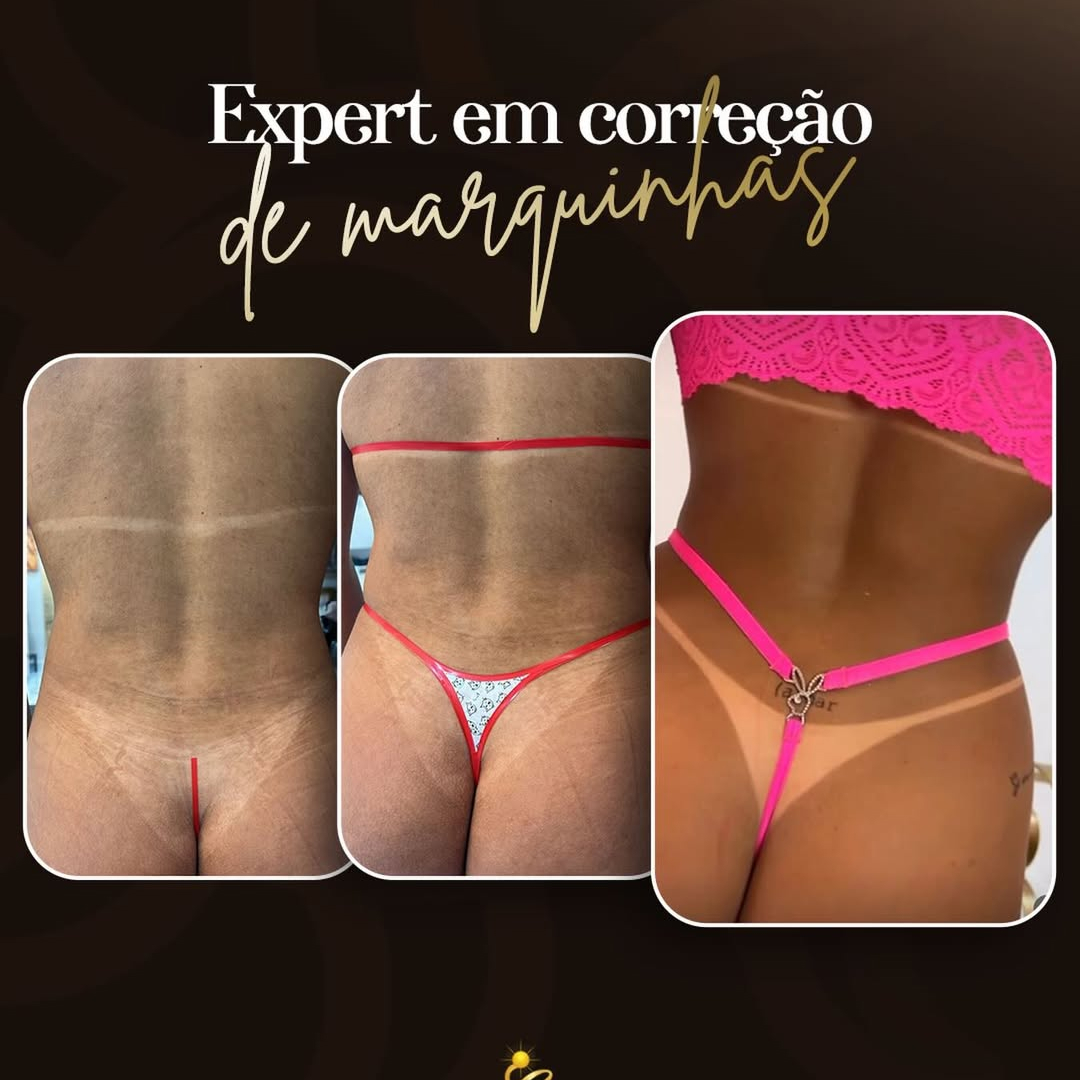 Correção de marquinhas-nós fazemos e somos referência